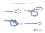 Surgeons End Loop